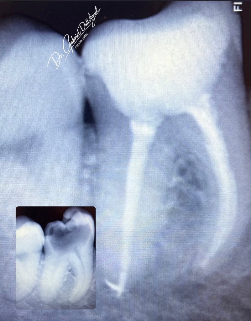 Endodontia