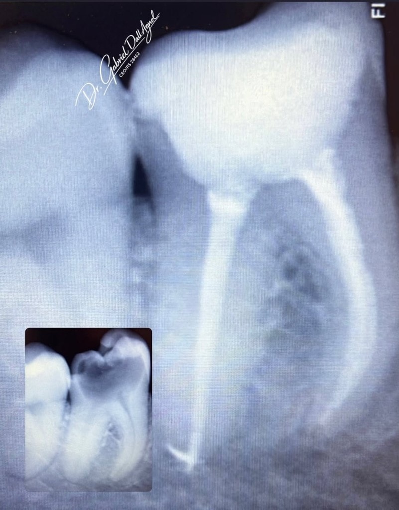 Endodontia